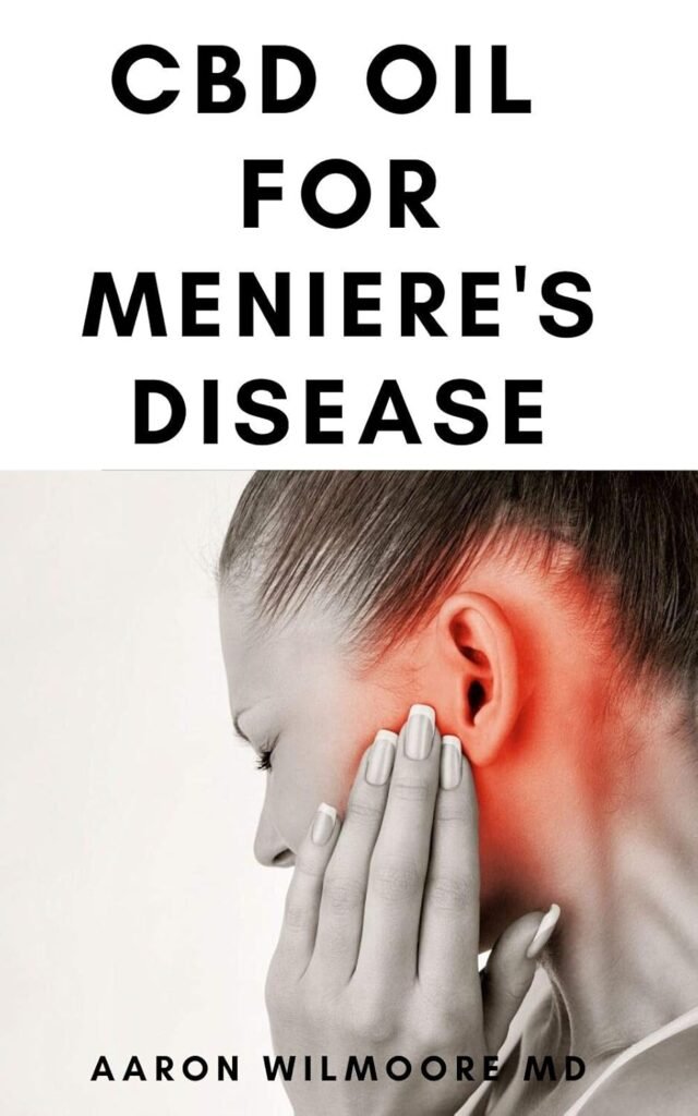 CBD Oil for Meniere’s Disease: All You Need To Know About How CBD OIL WORKS for Meniere’s Disease     Kindle Edition